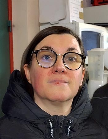BLACHON Marion